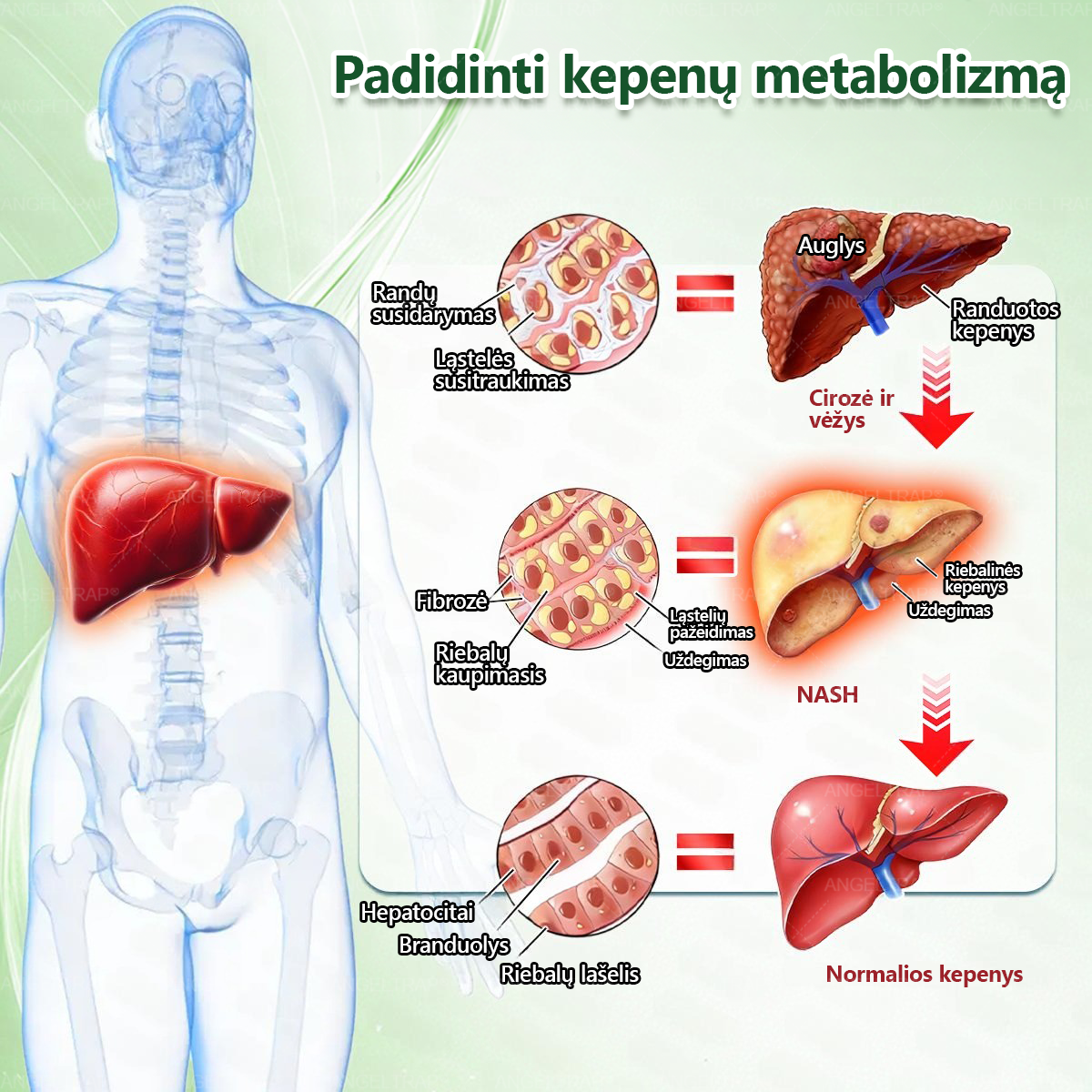 👩‍⚕️ 𝐴𝑁𝐺𝐸𝐿𝑇𝑅𝐴𝑃® 𝐌𝐨𝐫𝐢𝐧𝐠𝐚 × 𝐁𝐞𝐫𝐛𝐞𝐫𝐲𝐧𝐚 × 𝐀𝐌𝐏𝐊 𝟏𝟎 в 𝟏 – Nano mikroadatinis pleistras svorio metimui | Tik 1 kartą per dieną ✅ Matomi pokyčiai per 𝟕 dienas – nutukimui, širdies ir kraujagyslių sveikatai, diabetui ir sąnarių problemoms gydyti